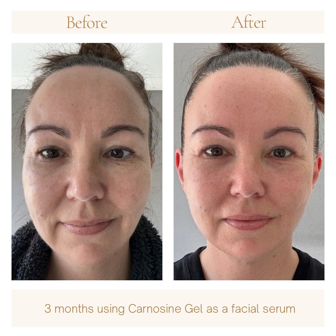 Before and after three months, front