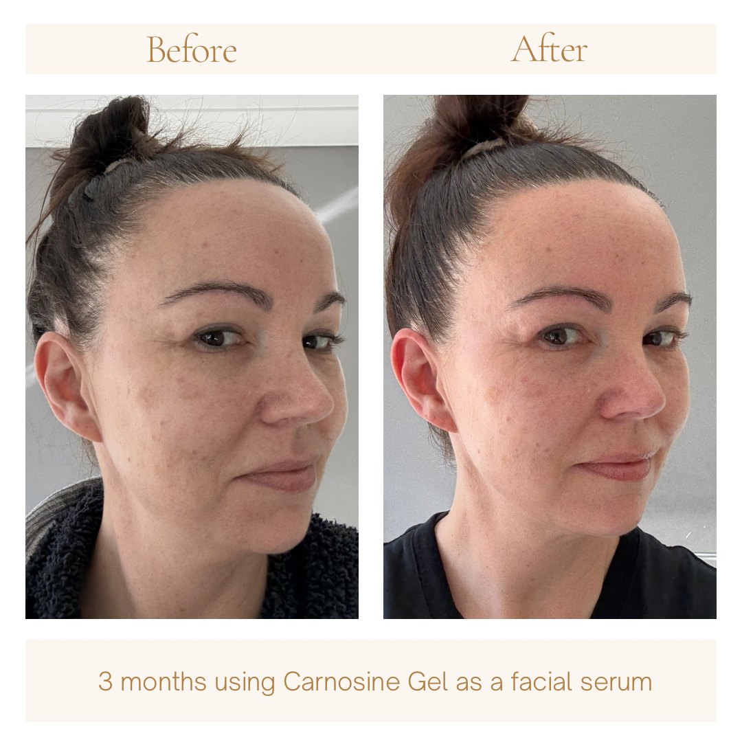 Before and after three months, three-quarter