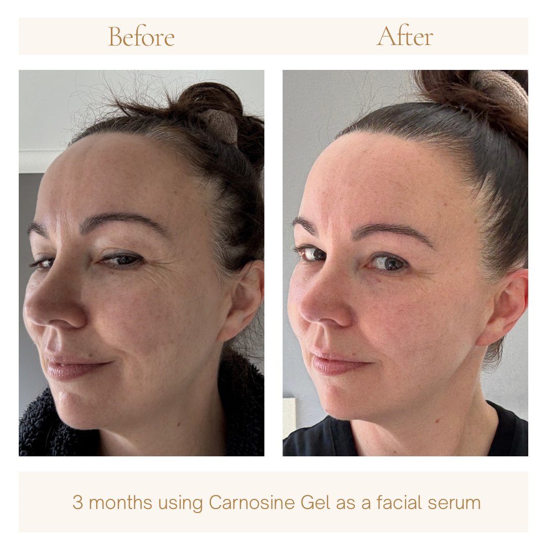 Before and after three months, side