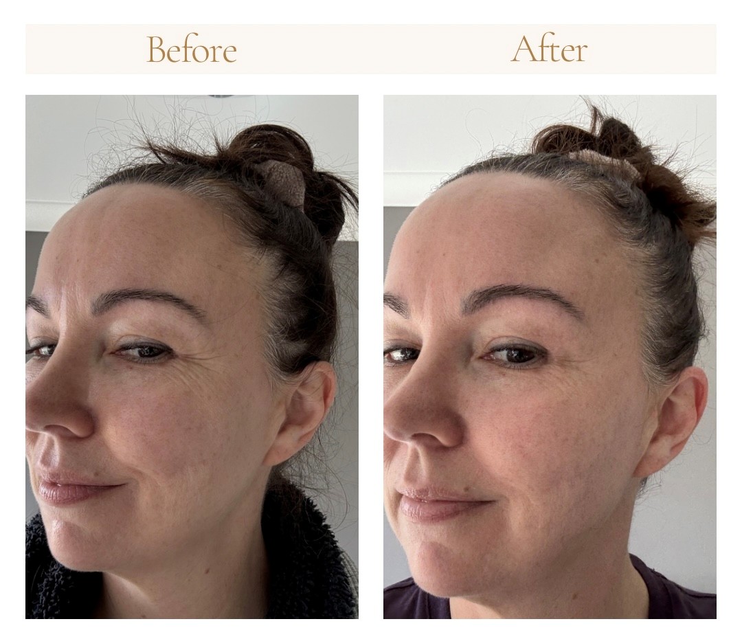 Before and after, three-quarter