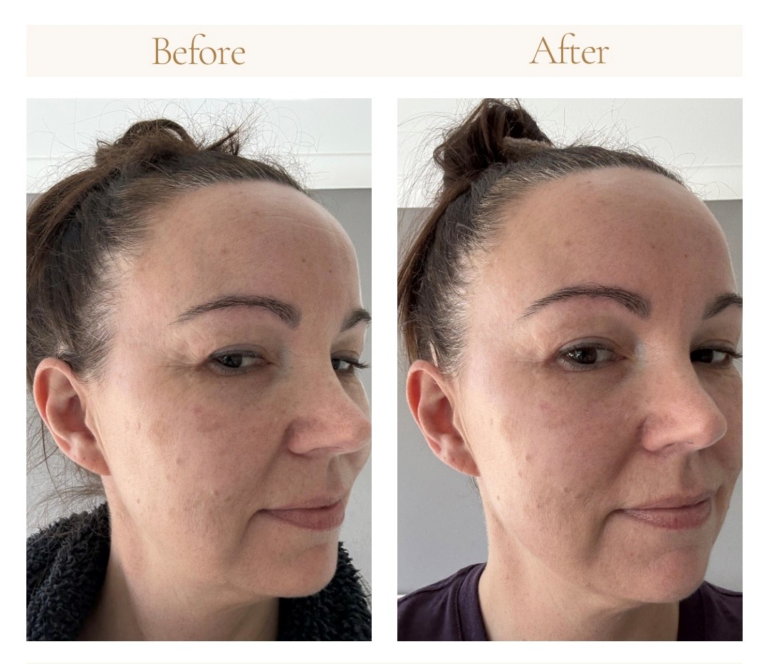 Before and after, side