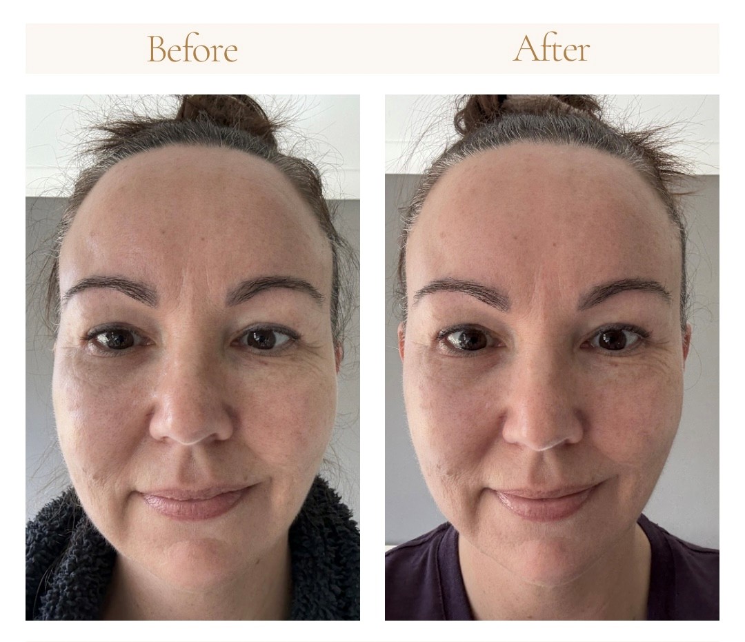 Before and after, front